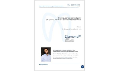 Dr. Giuseppe Chiodera - Diamond24, 24 solutions for your restorations of Class II cavities