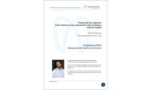 Dr. Giuseppe Chiodera – Protecting the adjacent tooth – PolydentiaPRO interproximal protection matrix
