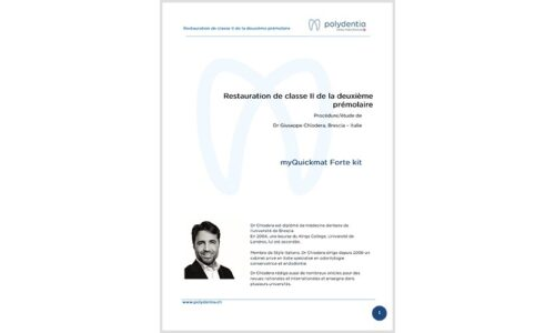 Dr. Giuseppe Chiodera – Restauration de classe II de la deuxième prémolaire – myQuickmat Forte kit