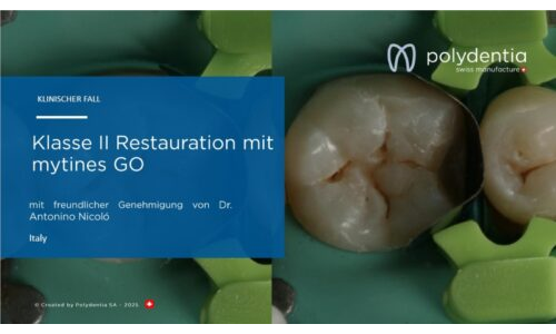 Dr Antonino Nicolo - Klasse II Restauration mit mytines GO
