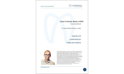 Dr. David Gerdolle – Clase II mesial, distal y MOD – MyClip 2.0 + LumiContrast