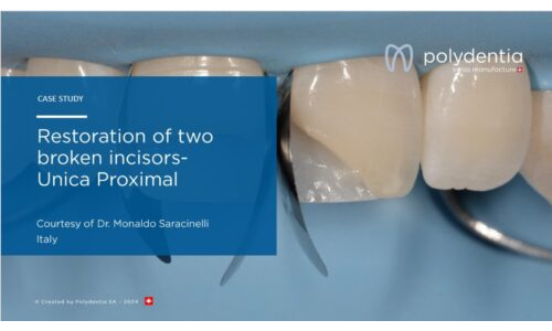 Dr Monaldo Saracinelli - Restoration of two broken incisors  Unica Proximal