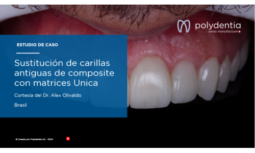 Dr Alex Olivaldo - Sustitución de carillas antiguas de composite con matrices Unica