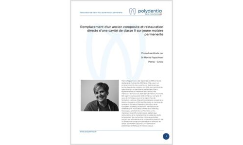 Dr. Marina Papachroni - Remplacement d'un ancien composite et restauration de classe II sur jeune molaire permanente - myRing Forte