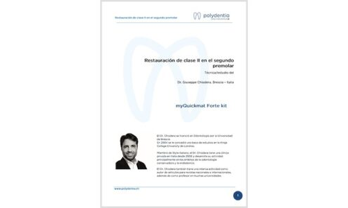Dr. Giuseppe Chiodera– Restauración de clase II en el segundo premolar – Quickmat Forte kit