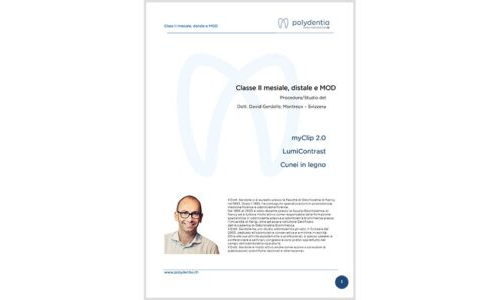 Dr. David Gerdolle – Classe II mesiale, distale e MOD – MyClip 2.0 + LumiContrast