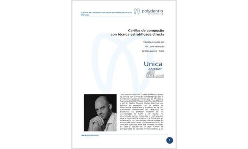 Dr. Jordi Manauta – Carillas de composite con técnica estratificada directa – Unica anterior