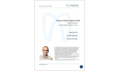 Dr. David Gerdolle – Classe II mésial, distal et MOD – MyClip 2.0 + LumiContrast