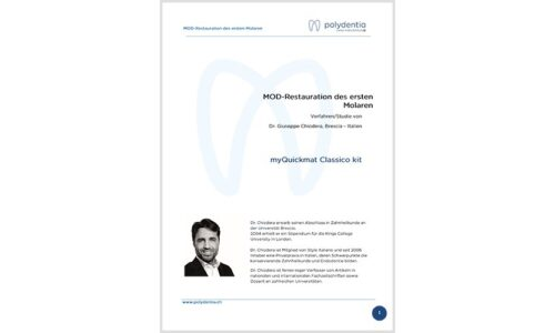 Dr. Giuseppe Chiodera – MOD-Restauration des ersten Molaren – myQuickmat Classico kit