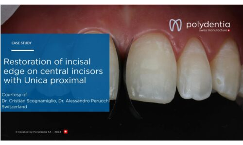 Dr Scognamiglio - Dr Perucchi - Restoration of incisal edge on central incisors with Unica proximal