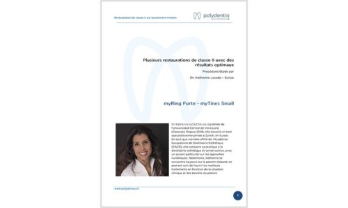 Dr. Katherine Losada – Plusieurs restaurations de classe II avec des résultats optimaux – myQuickmat Forte kit