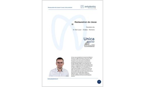 Dr. Dan Lazar – Restauration de classe III – Unica anterior