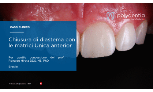 Dr Ronaldo Hirata - Chiusura di diastema con le matrici Unica anterior