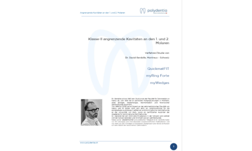 Dr. David Gerdolle - Klasse-II angrenzende Kavitäten an den 1. und 2. Molaren mit anatomischen QuickmatFIT-Teilmatrizen