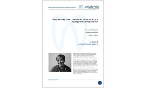 Dr. Marina Papachroni - Class II cavity direct composite restoration on a young permanent premolar – myClip 2.0