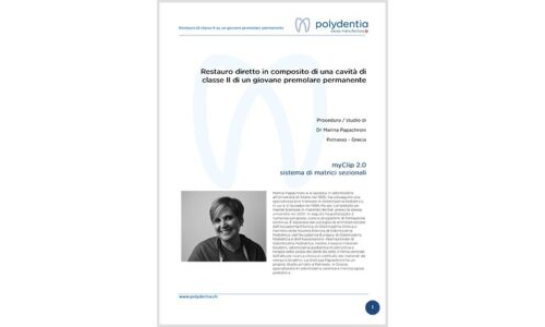Dr. Marina Papachroni - Restauro diretto in composito di una cavità di classe II di un giovane premolare permanente – myClip 2.0