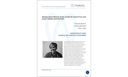 Dr. Marina Papachroni -Restauration directe d’une cavité de classe II sur jeune molaire permanente – myQuickmat Forte