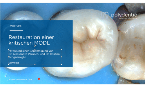 Dr Scognamiglio - Dr Perucchi - Restauration einer kritischen MODL