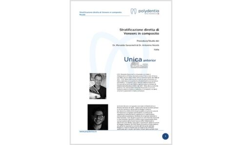 Dr. Saracinelli & Nicolò – Stratificazione diretta di Veneers in composito – Unica anterior