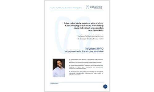 Dr. Giuseppe Chiodera –Schutz des Nachbarzahns – PolydentiaPRO Interproximale Zahnschutzmatrize