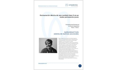 Dr. Marina Papachroni -Restauración directa de una cavidad clase II en un molar permanente joven – myQuickmat Forte