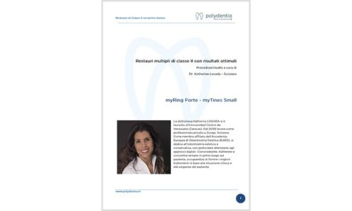 Dr. Katherine Losada – Restauri multipli di classe II con risultati ottimali – myQuickmat Forte kit