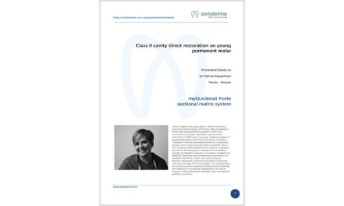 Dr. Marina Papachroni - Class II cavity direct restoration on young permanent molar with myQuickmat Forte
