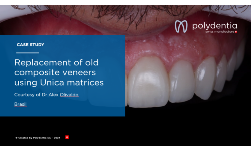 Dr Alex Olivaldo - Replacement of old composite veneers using Unica matrices