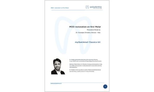 Dr. Giuseppe Chiodera – MOD restoration on first Molar – myQuickmat Classico kit