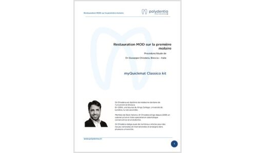 Dr. Giuseppe Chiodera – Restauration MOD sur la première molaire – myQuickmat Classico kit