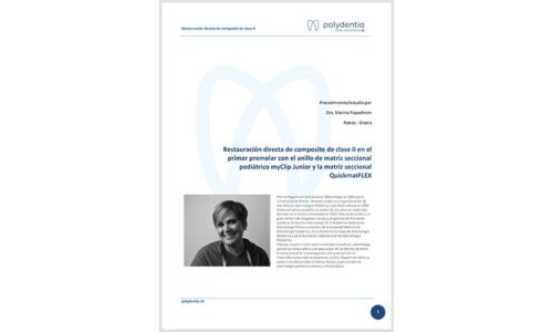 Dr. Marina Papachroni – Restauración directa de composite de clase II en el primer premolar – QuickmatFLEX matrices seccionales y myClip Junior