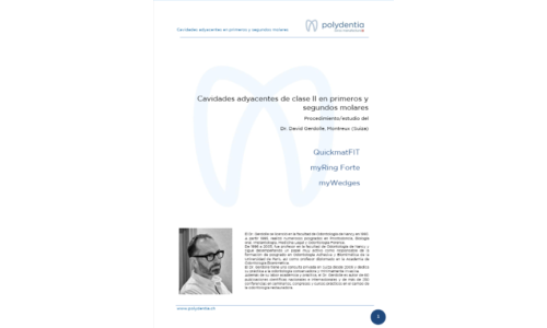 Dr. David Gerdolle - Cavidades adyacentes de clase II en primeros y segundos molares con las matrices anatómicas seccionales QuickmatFIT