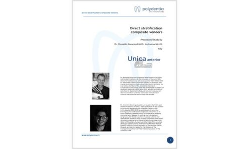 Dr. Saracinelli & Nicolò – Carillas de composite con técnica estratificada directa – Unica anterior