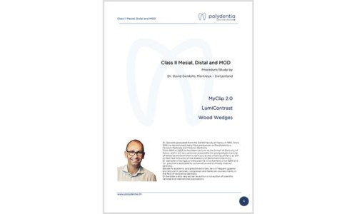 Dr. David Gerdolle – Class II Mesial, Distal and MOD – MyClip 2.0 + LumiContrast