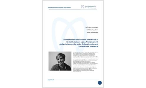Dr. Marina Papachroni – Direkt Restauration einer Klasse-II-Kavität an einem ersten Prämolaren – QuickmatFLEX sectional matrices e myClip Junior