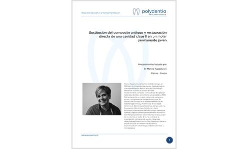 Dr. Marina Papachroni - Sustitución del composite antiguo y restauración directa de una cavidad clase II en un molar permanente joven - myRing Forte