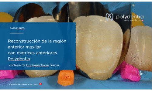 Dr. Marina Papachroni – Reconstrucción de la región anterior maxilar  con matrices anteriores