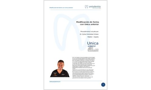 Dr. Carlos Fernández Villares – shape modification – Unica anterior