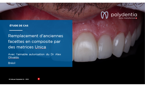 Dr Alex Olivaldo - Remplacement d'anciennes facettes en composite par des matrices Unica