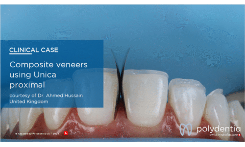 Dr Ahmed Hussain - Composite veneers using Unica  proximal