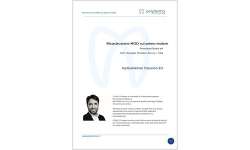 Dr. Giuseppe Chiodera – MOD restoration on first Molar – myQuickmat Classico kit