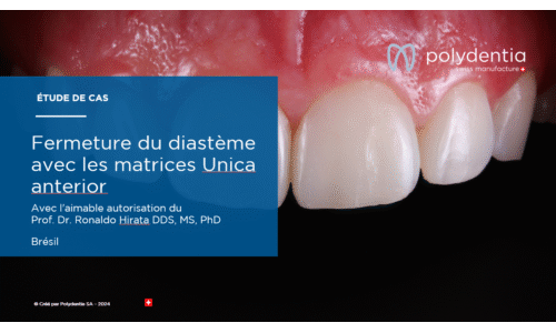 Dr Ronaldo Hirata - Fermeture du diastème avec les matrices Unica anterior