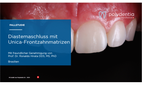 Dr Ronaldo Hirata - Diastemaschluss mit Unica-Frontzahnmatrizen