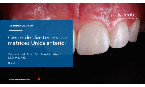 Dr Ronaldo Hirata - Cierre de diastemas con matrices Unica anterior