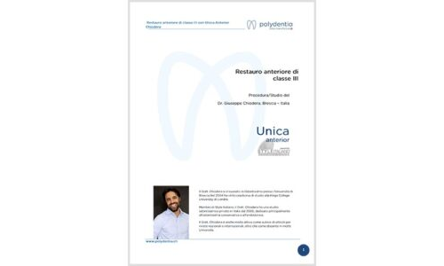 Dr. Chiodera – Restauro anteriore di classe III – Unica anterior