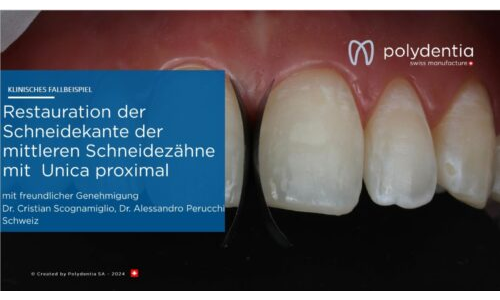 Dr Scognamiglio - Dr Perucchi - Restauration der Schneidekante der mittleren Schneidezähne mit  Unica proximal