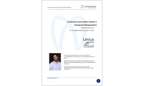 Dr. Giuseppe Chiodera – Austausch einer alten Klasse V Komposit-Restauration- Unica Anterior