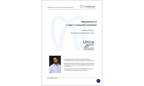 Dr. Giuseppe Chiodera – Replacement of a class V composite restoration – Unica anterior