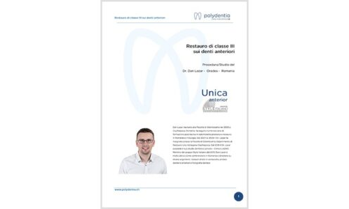 Dr. Dan Lazar – Restauro di classe III sui denti anteriori – Unica anterior