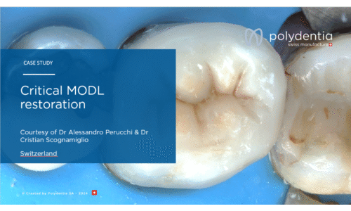Dr Scognamiglio - Dr Perucchi - Critical MODL restoration